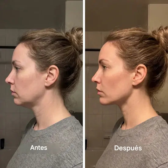 FaceUp™ - Efecto lifting en segundos - Sorprendente masajeador de drenaje linfático para cara