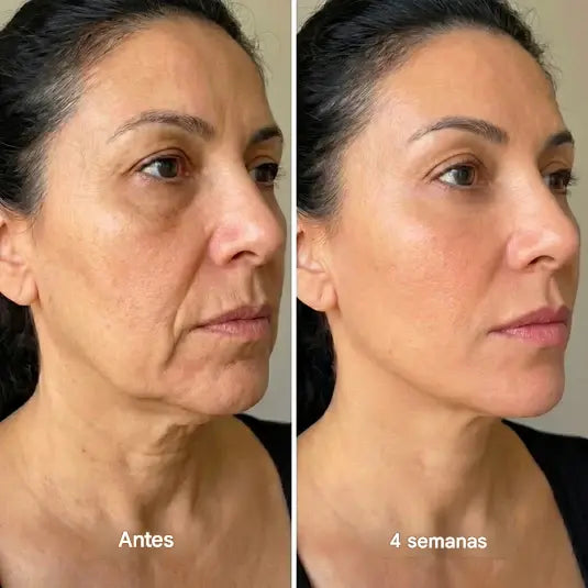 FaceUp™ - Efecto lifting en segundos - Sorprendente masajeador de drenaje linfático para cara