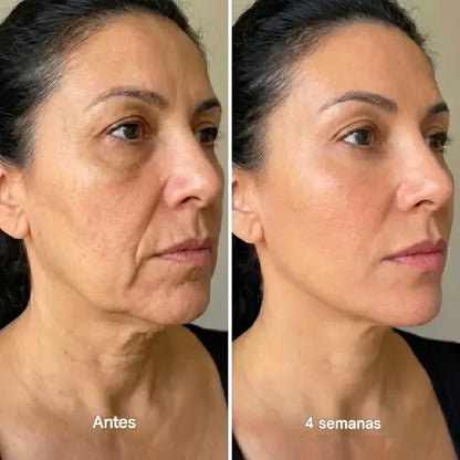 FaceUp™ - Efecto lifting en segundos - Sorprendente masajeador de drenaje linfático para cara
